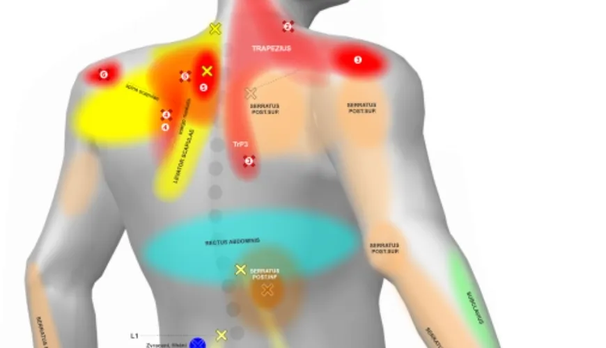 Come capire e trattare il mal di schiena grazie alla mappa del corpo