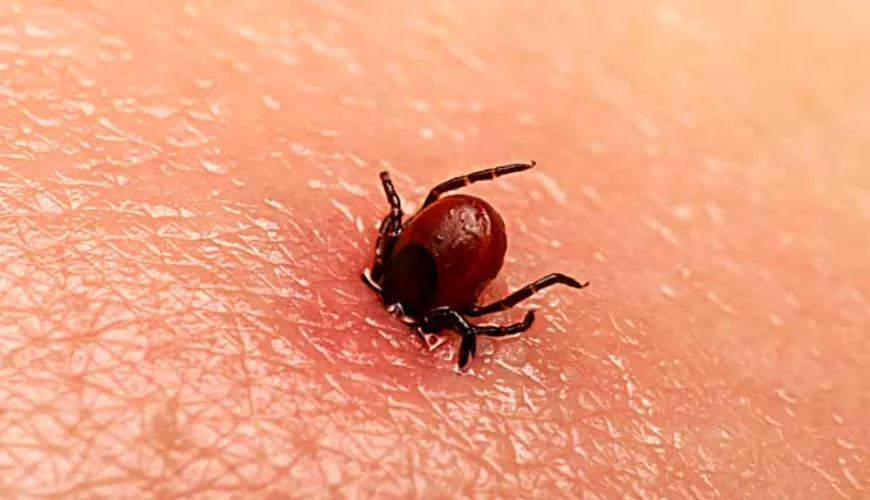 La borreliosi può manifestarsi anche senza il morso di una zecca