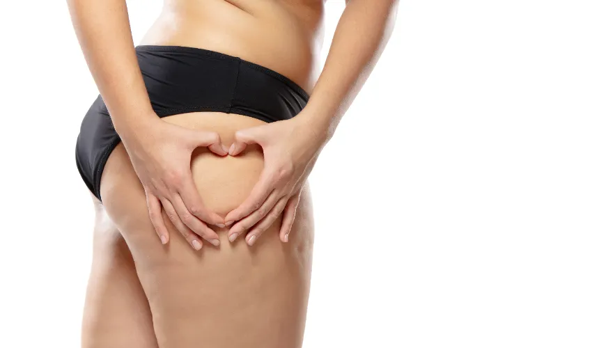 Come si forma la cellulite e cosa influisce sulla sua visibilità